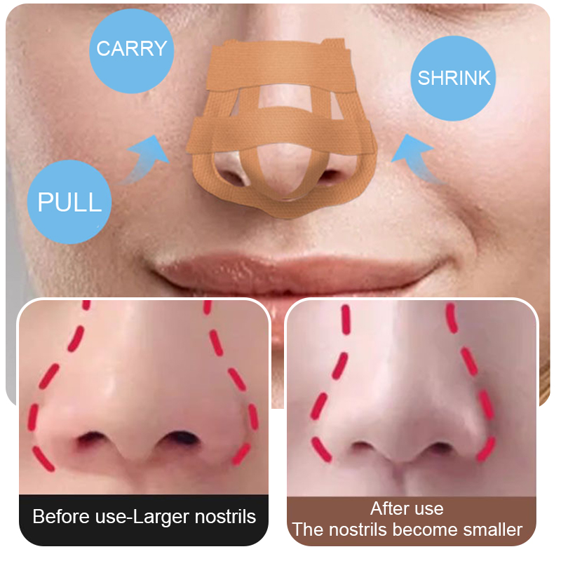 Beauty Nose Up Lifting Bridge  - đánh giá và giá Nose Trimmer