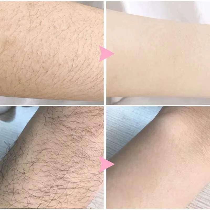 2 Minutes Painless Fast Hair R - đánh giá và giá Shaving Cream